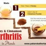 Manfaat Madu Untuk Mengatasi Nyeri Sendi