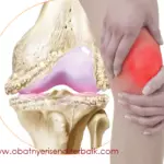 Cara Mengobati Pengapuran Tulang Belakang Secara Alami