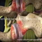 Fakta Tentang Sendi Yang Perlu Anda Ketahui