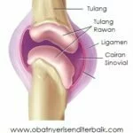 5 Cara Perawatan Untuk Tulang Rawan Sendi